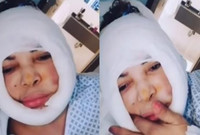 نشرت على صفحتها فيديو لها بعد انتهائها من عملية التجميل وظهر فيه وجهها متورمًا ثم حذفته سريعًا من على حسابها 

